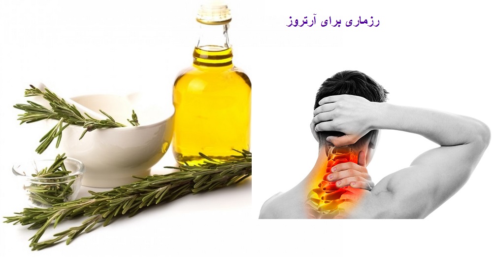 رزماری با آرتروز مبارزه میکند